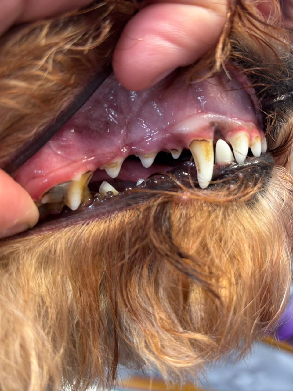 Dientes antes de la limpieza dental sin anestesia